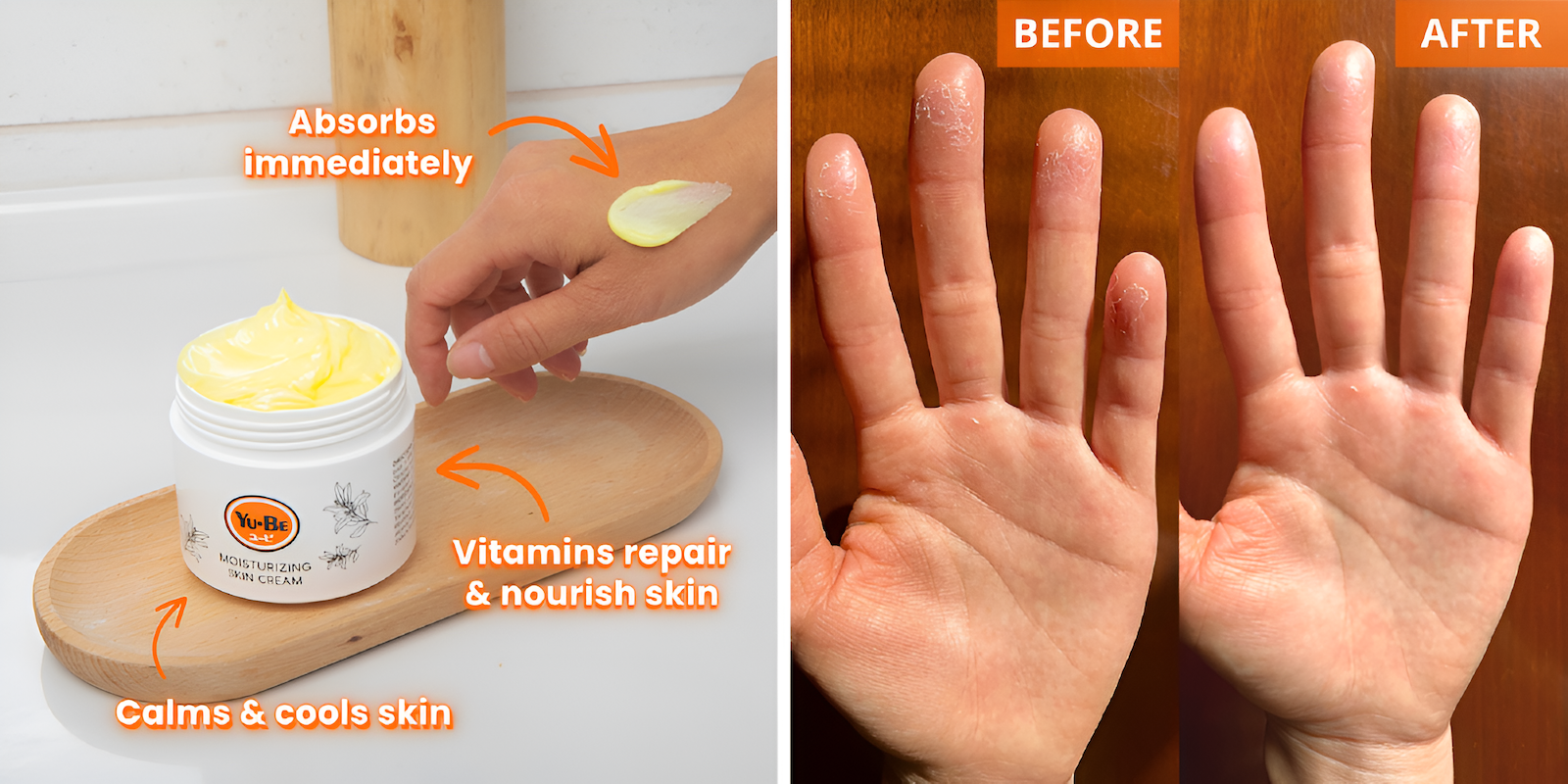 yu be moisterizing creams